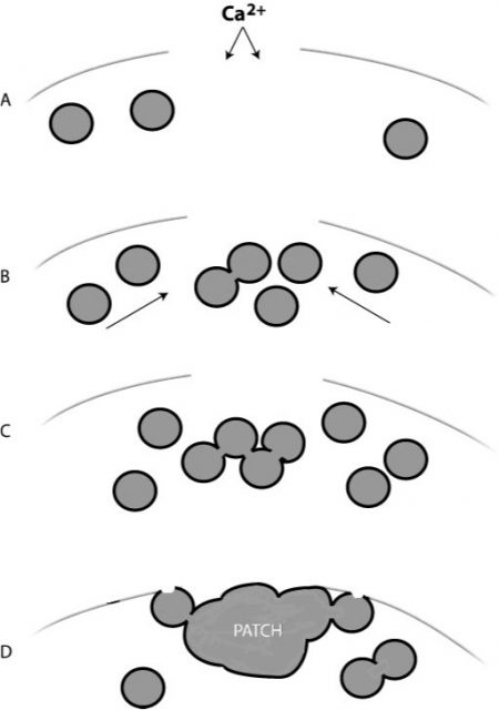 Mechanism to repair the membrane: the patch hypothesis. (A) Ca2+ enters through the disruption. (B) Vesicles accumulate at the hole by kinesin- and/or myosin-based transport systems. Ca2+-triggered vesicle-vesicle homotypic fusion begins. (C) Forming a large patch vesicle. (D) Fusion of the patch vesicle with the plasma membrane completes the seal. | Credits: McNeil et al (2003)