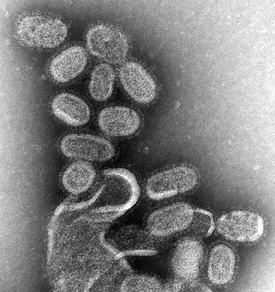 Figure 1. Negative stained transmission electron micrograph (TEM) of influenza virus recreated 1918 influenza virions. | Credit: Wikimedia Commons