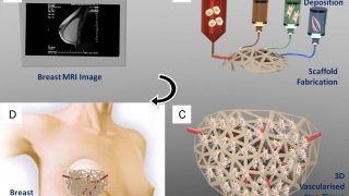 Can 3D printing mark a turning point in tissue engineering?