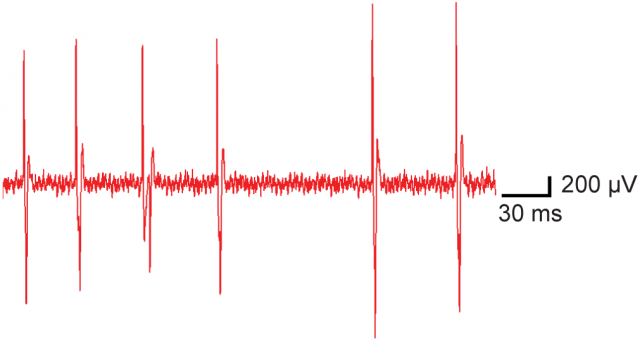 Figure 5. In vivo extracellular recordings from mouse brain somatosensory cortex. | Credit: Yoon et al. (2013). 