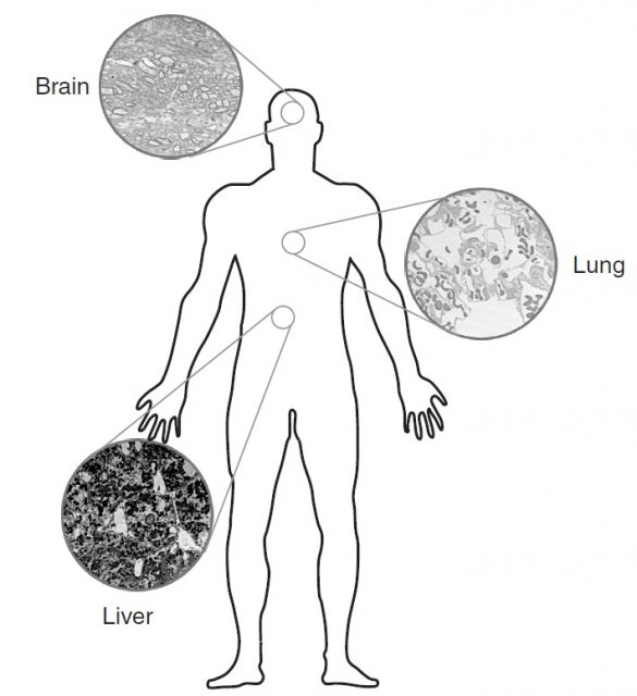 Figure 4. Particulate accumulation in the lung, liver and brain due to the entry of nanoparticles within the body via the airways. | Credit: Elsaesser and Howard (2012)