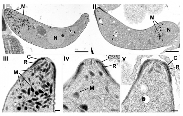 Figure 3. Longitudinal view of a wild type (left) and an SHLP1 KO (right) ookinete. The intense, dark little structures accumulated in the apical end of the wild type parasite, lacking in the mutant, are the micronemes (see text and Ref. 1 for details)