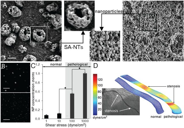 Figure1. (A) Scanning electron micrographs of the microscale (~2 to 5 μm) SA-NTs (left) and the PLGA nanoparticles (~180 nm) used to produce them (right). Scale bar, 2 μm. (B) Fluorescence micrographs demonstrating intact SA-NTs (top) and NPs dispersed after their exposure to 1000 dyne/cm2 for 10 min by using a rheometer (bottom). Scale bar, 10 μm. (C) Quantification of release of fluorescent NPs from the SA-NTs as a function of shear. (D) CFD simulations comparing fluidic shear stress in a normal coronary artery (left) and a stenotic vessel with a 60% lumen obstruction (right). Left inset shows the corresponding angiogram of the stenotic left coronary artery in a 63-year-old male patient. | Credit: Korin et al (2012)