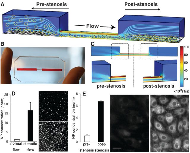 Figure 2. (A) Microfluidic vascular stenosis model showing how SA-NTs (large spheres) should remain intact in the prestenotic region but then break up into NPs (small spheres) when they flow through a constriction (90% lumen occlusion) and can accumulate in endothelial cells lining the bottom of the channel. (B) Microdevice that mimics vascular stenosis fabricated in PDMS. (C) CFD simulations of the microfluidic device shown in (B) demonstrating 100-fold increase in shear rate in the region displaying 90% lumen occlusion. (D) Release of fluorescent NPs from SA-NTs through the channel shown in (B) compared with flow through an unconstricted channel. Fluorescent micrographs compare the NPs collected in the outflow from the control channel (top) versus the constricted channel (bottom). Scale bar, 2 μm. (E) Concentration of nanoparticles in endothelial cells lining the downstream area (poststenosis) of the constriction relative to an upstream area. Fluorescence microscopic images show cells from regions before (left) and after (right) the constriction. Scale bar, 20 μm. | Credit: Korin et al (2012)