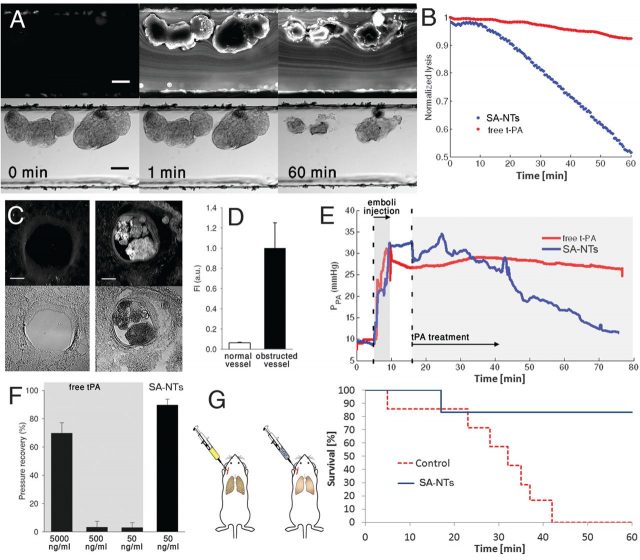 Figure 4. Shear-targeting of a thrombolytic drug to vascular emboli in vitro and therapeutic delivery in a mouse pulmonary embolism model. (A) Time-lapse fluorescence (top) and bright field (bottom) views of artificial microemboli (~250 μm) in a microfluidic channel before (0 min) and 1 or 60 min after injection of SA-NTs coated with tPA (50 ng/ml), showing progressive lysis of the clots over time. Scale bar, 100 μm. (B) Emboli lysis kinetics induced by tPA-coated SA-NTs (50 ng/ml, blue line) compared with soluble tPA (red line). (C) Fluorescence (top) and phase contrast (bottom) views of histological sections of normal (left) versus obstructed (right) pulmonary arteries showing local accumulation of fluorescent NPs within the obstructing emboli in a mouse ex vivo lung ventilation-perfusion model. Scale bar, 100 μm. (D) Accumulation of fluorescent NPs in regions of obstructed versus nonobstructed vessels, as detected with microfluorimetry. (E) Real-time measurements of pulmonary artery pressure in the ex vivo pulmonary embolism model for tPA-coated SA-NTs (blue line) and free tPA (red line). (F) Pulmonary artery pressure within 1 hour for tPA SA-NTs, and free tPA at 50, 500 and 5000 ng/ml concentration. (G) Mice survival curve. | Credit: Korin et al (2012)