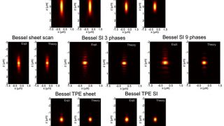 Bessel beam plane illumination microscopy: another smart solution for an old challenge.