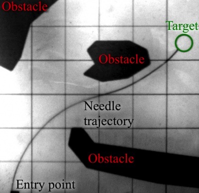 Figure 1. Example of flexible needle insertion into silicone phantom. Controlling the orientation of the bevel tip it is possible to control the trajectory. | Credit: Misra et al (2010)