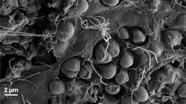 Figure 2. Apart from the damage that plastic could make on organisms and food webs, there is another interesting -and concerning- aspect to consider: there are ecosystems that have evolved to live in human-made plastic environments. Those ecosystems, named by marine biologist Erik Zettler as “Plastisphere”, may be changing the balance of the sea ecosystem. | Credit: Erik R. Zettler, Tracy J. Mincer, Linda A. Amaral-Zettler. Life in the “Plastisphere”: Microbial Communities on Plastic Marine Debris. Environmental Science & Technology, 2013; 130619162220002 DOI:10.1021/es401288x