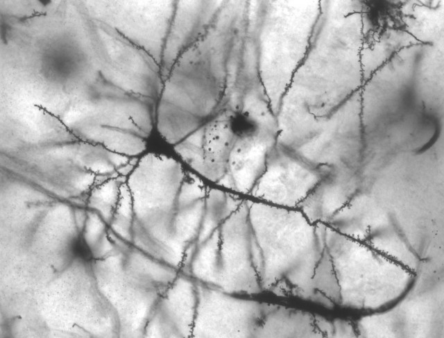 Figure 1. Pyramidal neurons receive inputs from thousands of other cells. | Credit: Wikimedia Commons