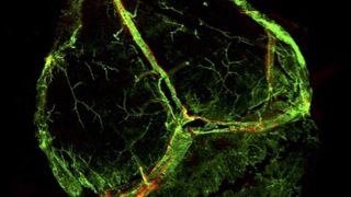 The brain has a direct connection to the lymphatic system