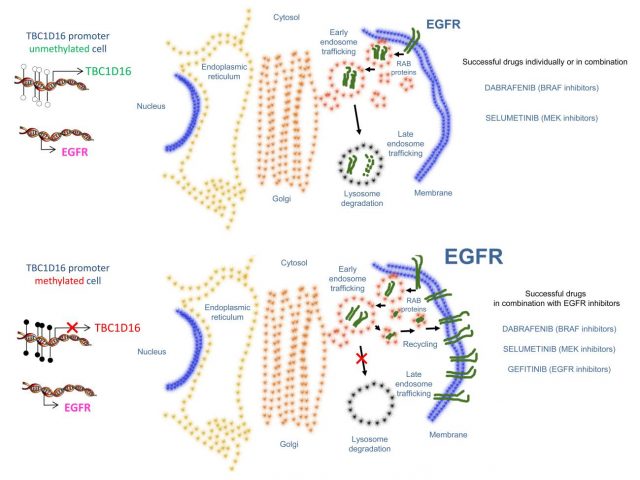 Figure 2. Melanoma patients expressing TBC1D16 protein will develop a metastasis earlier than those silenced for this gene. However, for the former patients, target therapies using BRAF or MEK inhibitors or their combination are succeeded to diminish tumor metastasis formation given an attenuation of EGFR/pAKT pathway.