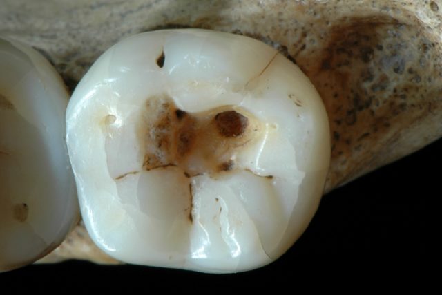 oldest-dentistry-150715