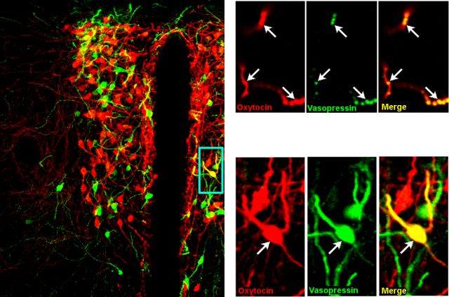 Figure 5. On the left: Paraventricular nucleus of the hypothalamus under the confocal microscope. Immunofluorescent staining of Oxytocin (red) and Vasopressin (green) allows visualization of somata, dendrites (thick processes) and axons (thin buttoned lines). Top right: Detail of nonapeptidergic fibers containing both Oxytocin (red) and Vasopressin (green). Bottom right: Detail of a neurosecretory cell (framed in blue on the left) containing both Oxytocin (red) and Vasopressin (green).