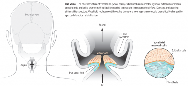 Restoring my voice