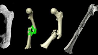 From bones to 3D(s): diffusion, didactics and diagnostics