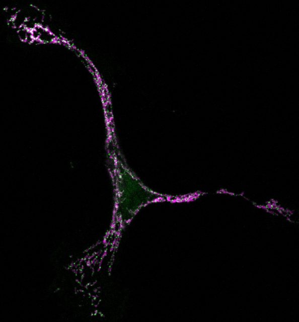 Figure 1. Confocal microscopy image of a mammalian cell undergoing apoptosis with the mitochondria stained in magenta and the protein Bax in green.