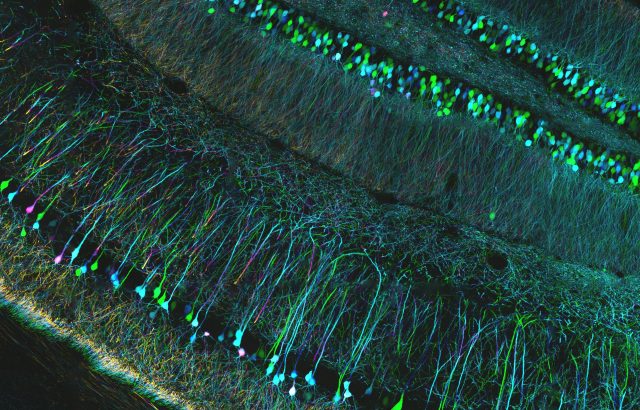 Confocal microscopy of mouse brain, detail. Source: https://www.flickr.com/photos/zeissmicro/10799673016