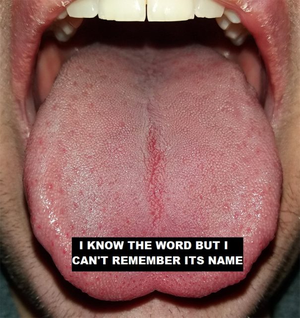 Some people may say “I know the word, but I can’t remember its name” when they are experiencing a “type of the tongue” state.