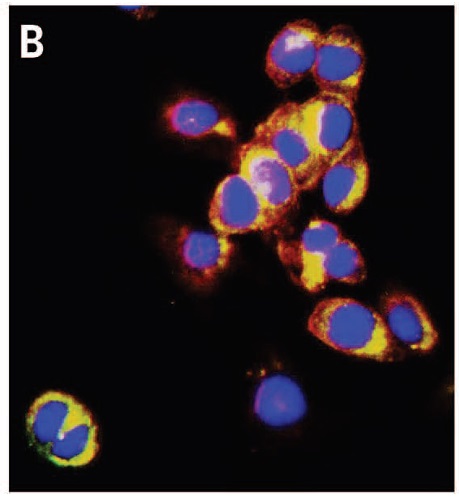 fluorescence images of cells stained with Au-pXs and with DAPI (4′,6- diamidino-2-phenylindole), and PKH-26 dyes, which respectively mark the nucleus and the cellularmembrane. Because Au-pXs are not functionalized with target-specific ligands, they disperse in the cytoplasm.