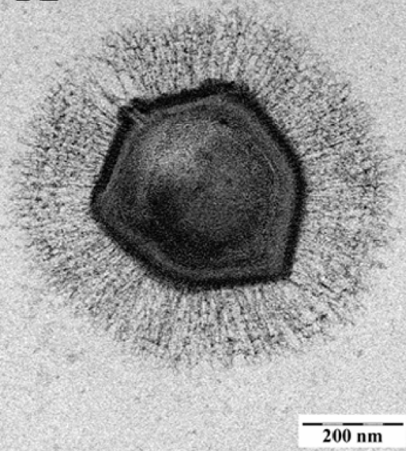 The Mimivirus, the first described giant virus Image credit: Wikimedia commons