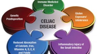 The recycling of data unveils genomic regions related to celiac disease