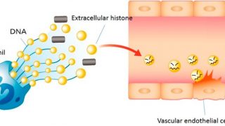 Using mass spectrometry to measure circulating histones against sepsis progression