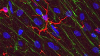 The art of forgetting: microglia eats memories away in mice