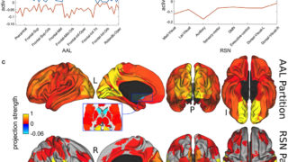 The metaestable resting state dynamics of the brain