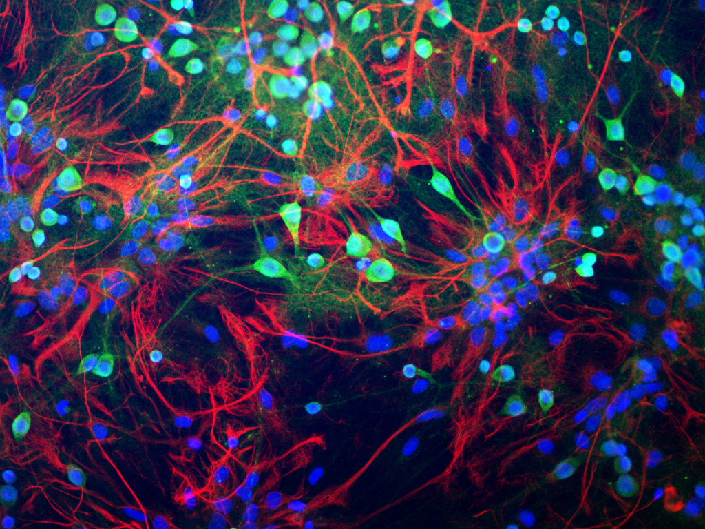 The fractal brain, from a single neuron's perspective - The Source