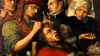 Extracting the stone of madness: the art of brain surgery in the Renaissance