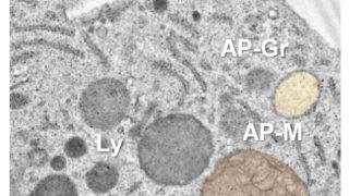 Lysosomes: the Achilles heel of brain macrophages during a stroke