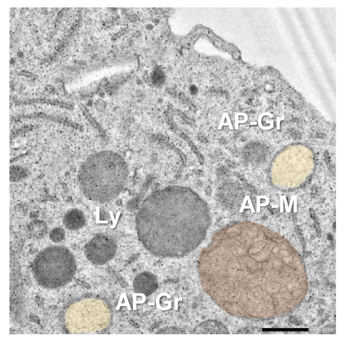 Lysosomes