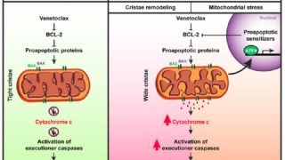 Targeting mitochondrial structure sensitizes acute myeloid leukemia to Venetoclax treatment