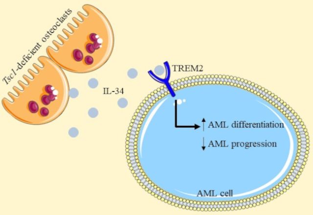 TREM2 acts as a receptor for IL-34 to suppress acute myeloid leukemia in mice