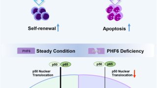 PHF6 maintains acute myeloid leukemia via regulating NF-κB signaling pathway