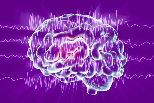 100 years of EEG have transformed neuroscience