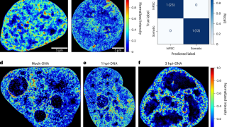 AINU, a powerful AI tool for studying cell heterogeneity