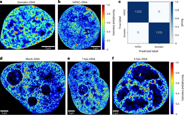 AINU, a powerful AI tool for studying cell heterogeneity