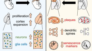 YF temporal dedifferentiation to solve neurodegeneration