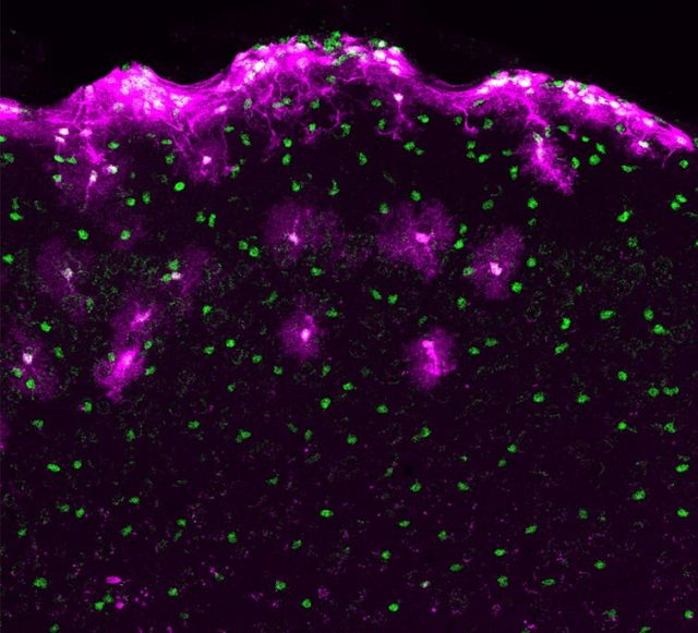 Astrocytes