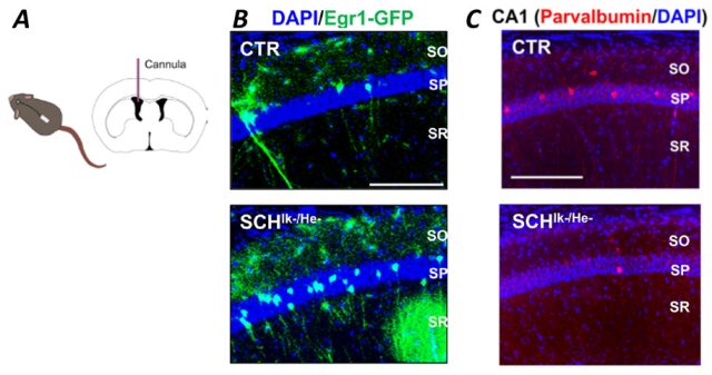 Immune signals affect neural circuits involved in schizophrenia