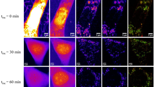 X-ray fluorescence imaging, a pivotal tool in modern biological research