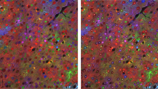 BiaPy, analising bioimages made easy