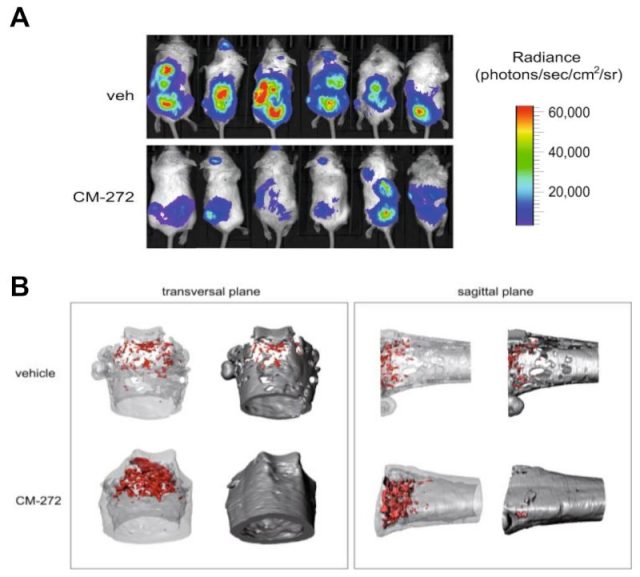 Targeting aberrant DNA methylation in mesenchymal stromal cells as a treatment for myeloma bone disease