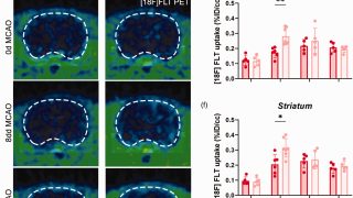 Rewiring the brain: How blocking adenosine boosts stroke healing