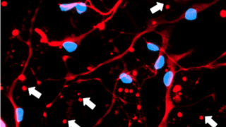 Zombosomes: The rise of astrocytic couriers in the propagation of brain disease