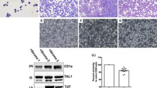 Stromal senescence drives therapy resistance in T-ALL
