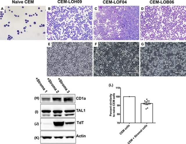 Stromal senescence drives therapy resistance in T-ALL