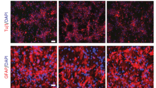 Neural stem cells discovered outside the mouse brain