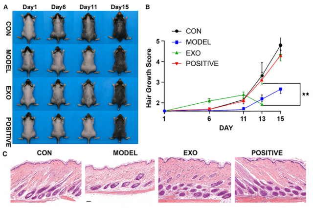 Secretome of dental pulp stem cells as a potential therapy for androgenetic alopecia